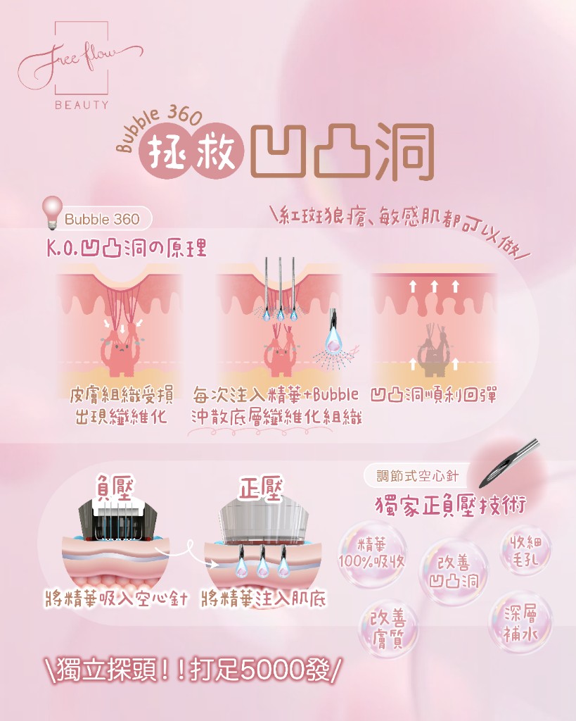 HB.Bubble K.O. 凹凸洞原理：纖維化分離、精華注入、凹凸回彈