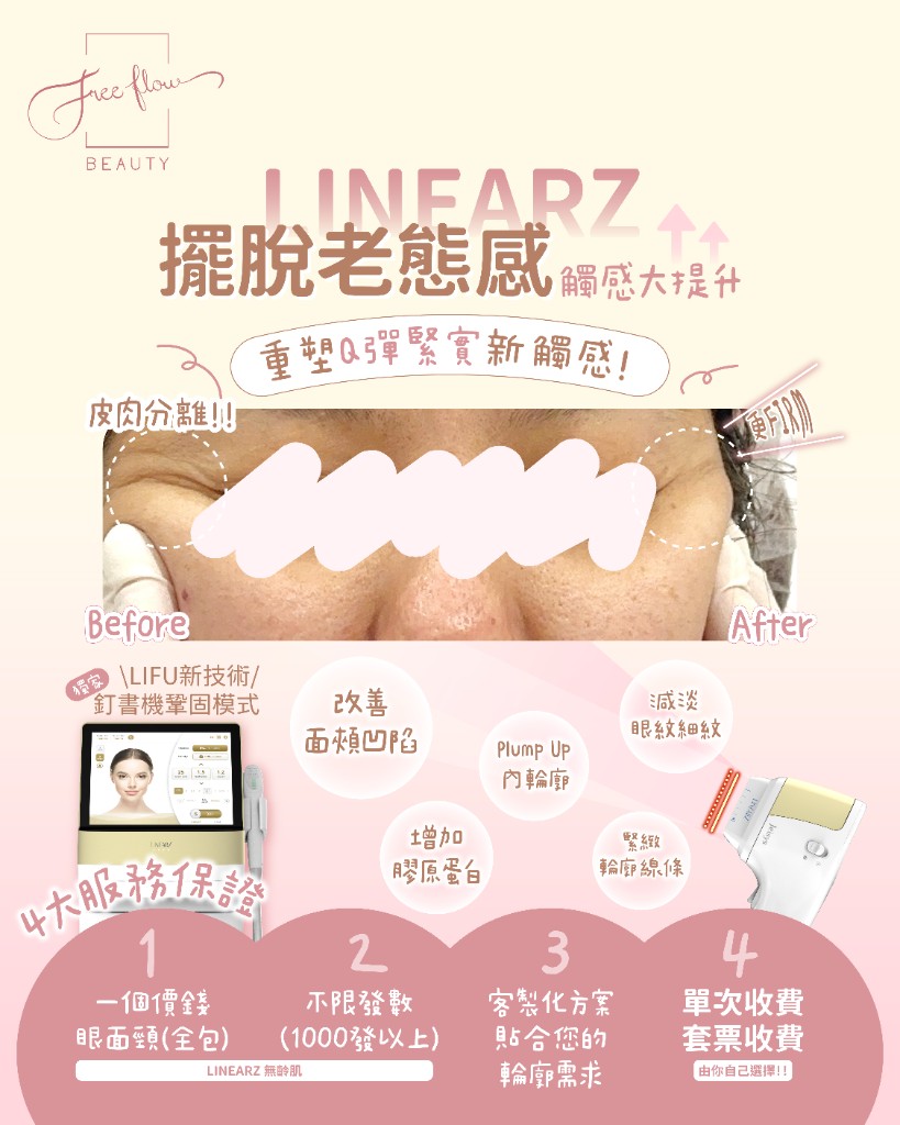 LinearZ 療程前後輪廓改善參考