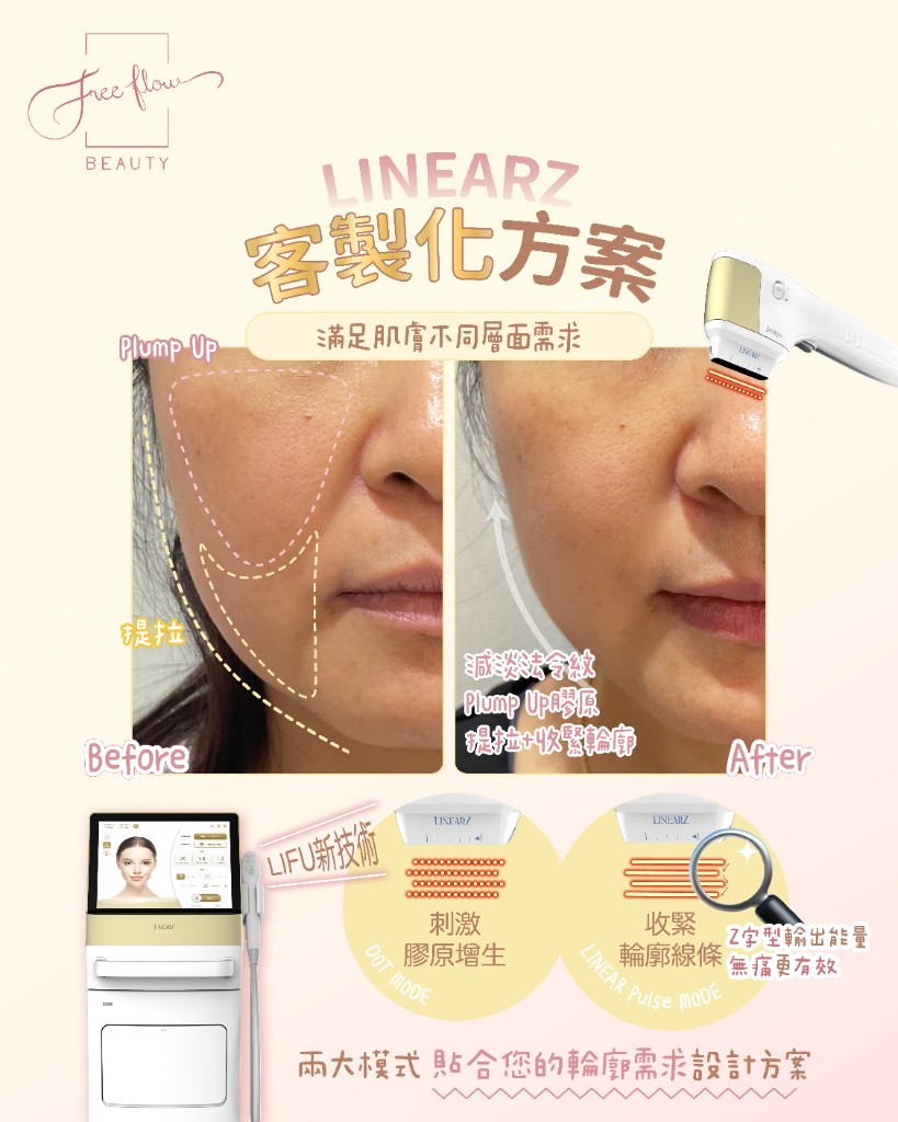 LinearZ 客製化方案示意